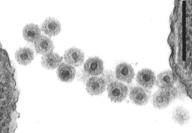 De M.M. Poranen and S. Mäntynen - <a rel="nofollow" class="external free" href="https://talk.ictvonline.org/ictv-reports/ictv_online_report/dsrna-viruses/w/cystoviridae">https://talk.ictvonline.org/ictv-reports/ictv_online_report/dsrna-viruses/w/cystoviridae</a>, CC BY-SA 4.0, Enlace