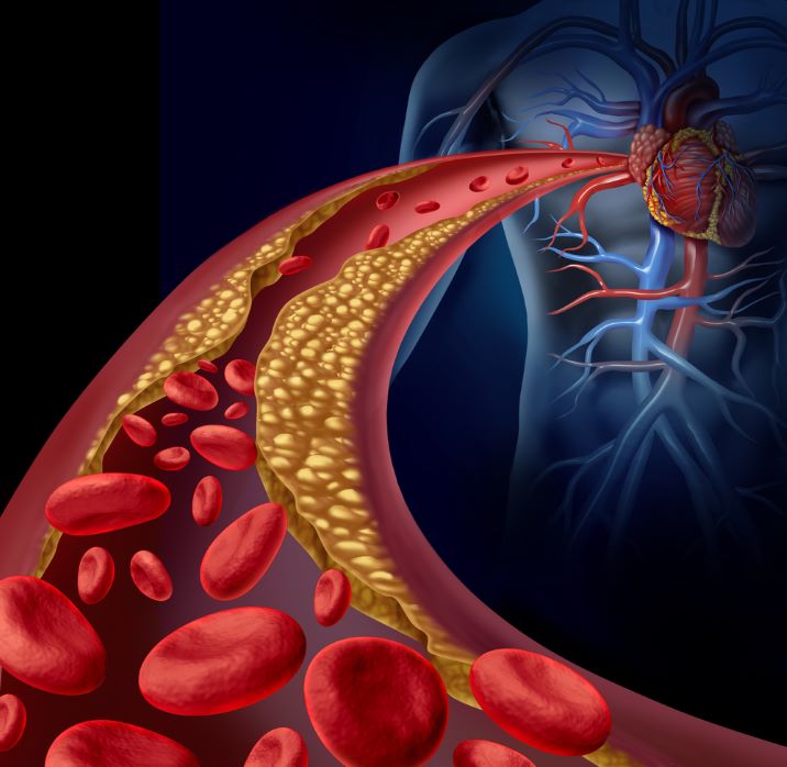 La prevención primaria es la principal herramienta para reducir las enfermedades cardiovasculares